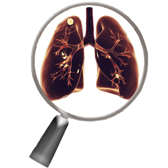Quantitative LDCT Analysis of Several Lung Cancer Screening Cohorts